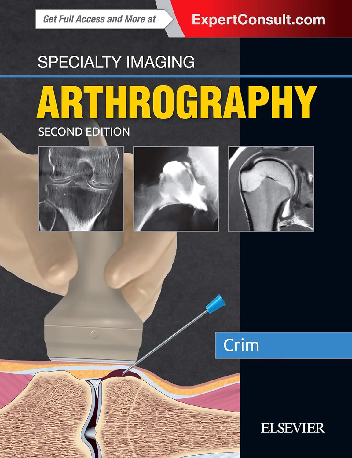 Specialty Imaging: Arthrography: 9780323594899: Medicine & Health ...