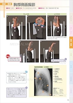 X線撮影法 中村貴 著 X線撮影法 中村貴 著