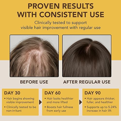 Miniatura 6 de Botanic Hearth Aceite de batana para el crecimiento del cabello, Dr. Sebi, 100% puro de Honduras, para el crecimiento del cabello, el tratamiento