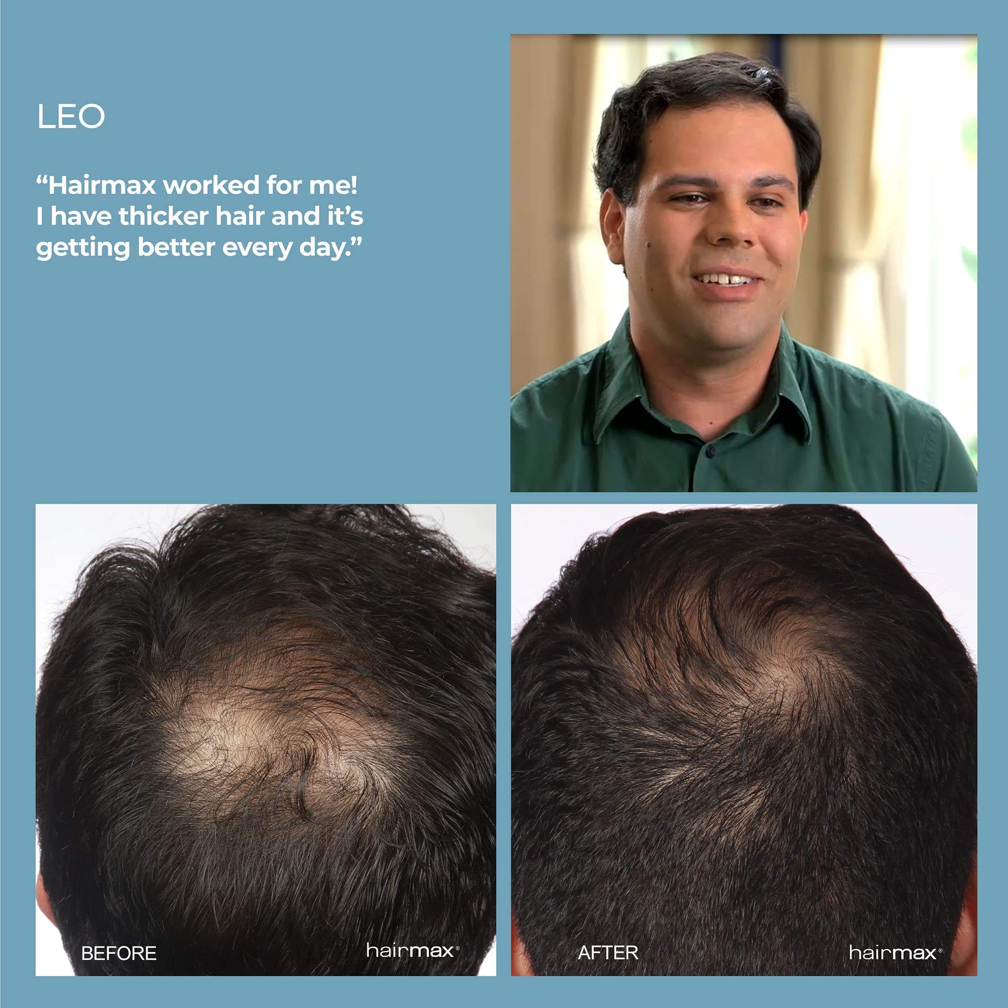HairMax Laser Hair Growth Comb, FDA Cleared, Ultima 12, Laser Hair