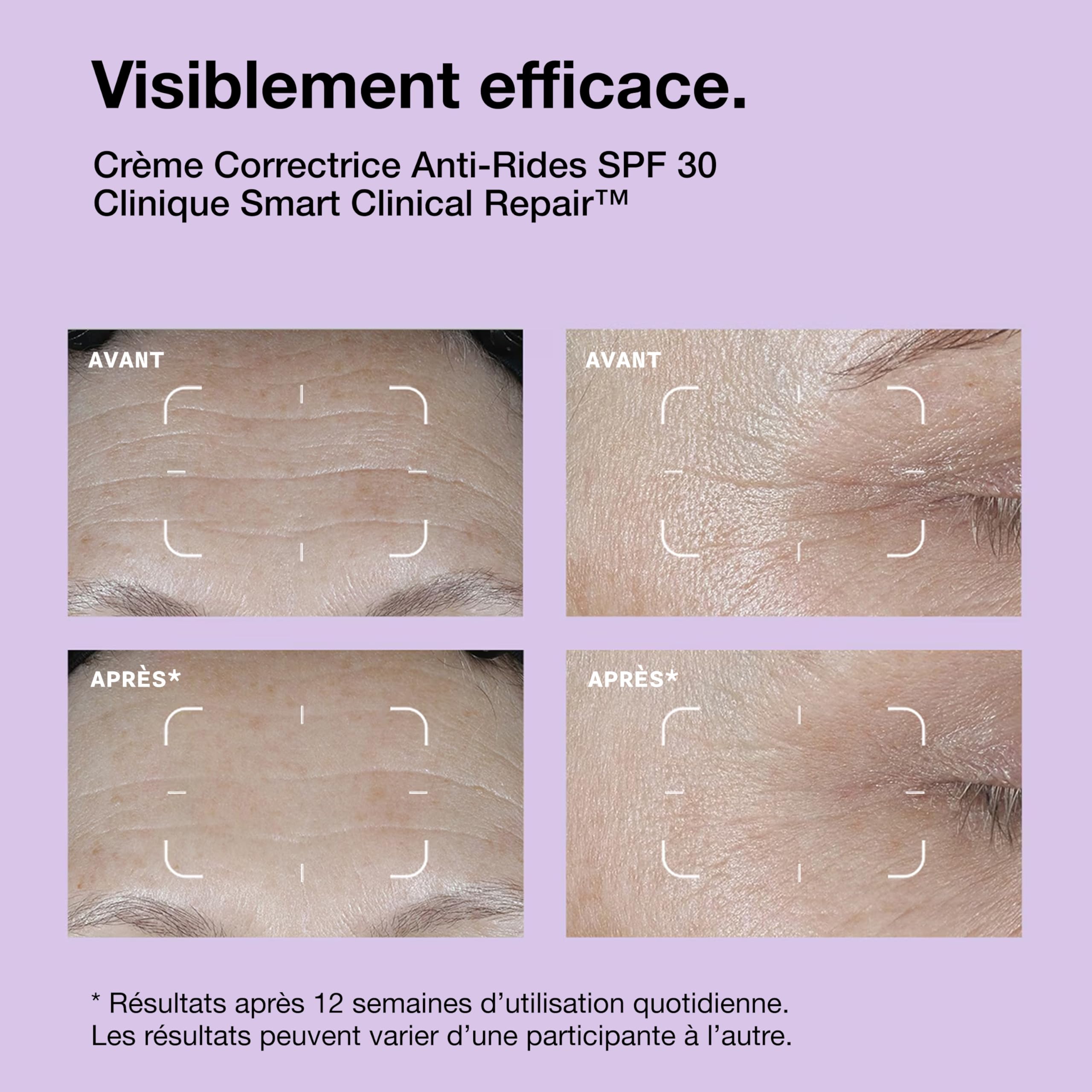 Clinique Smart Clinical Repair Crème Correctrice Anti-Rides SPF 30 aux Peptides, Acide Hyaluronique + Provitamine D | Protège et répare la Peau, 50 ml