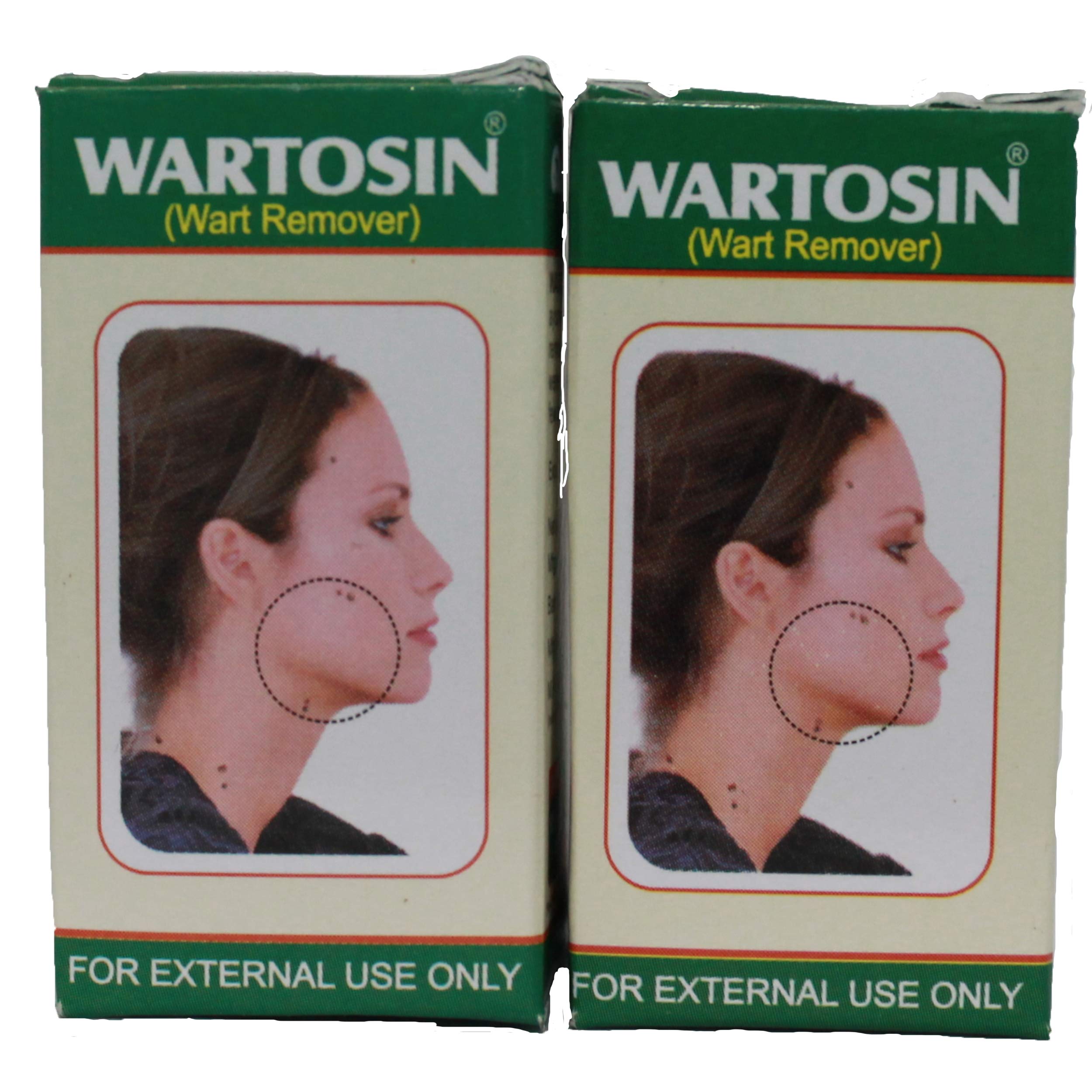 See full amazon price history chart for ESVEE Ayucare Wartosin Pack Of 2 ESVEE Ayucare Wartosin Pack Of 2 (B08LHD47SB) Amazon Price History, Amazon Price Tracker