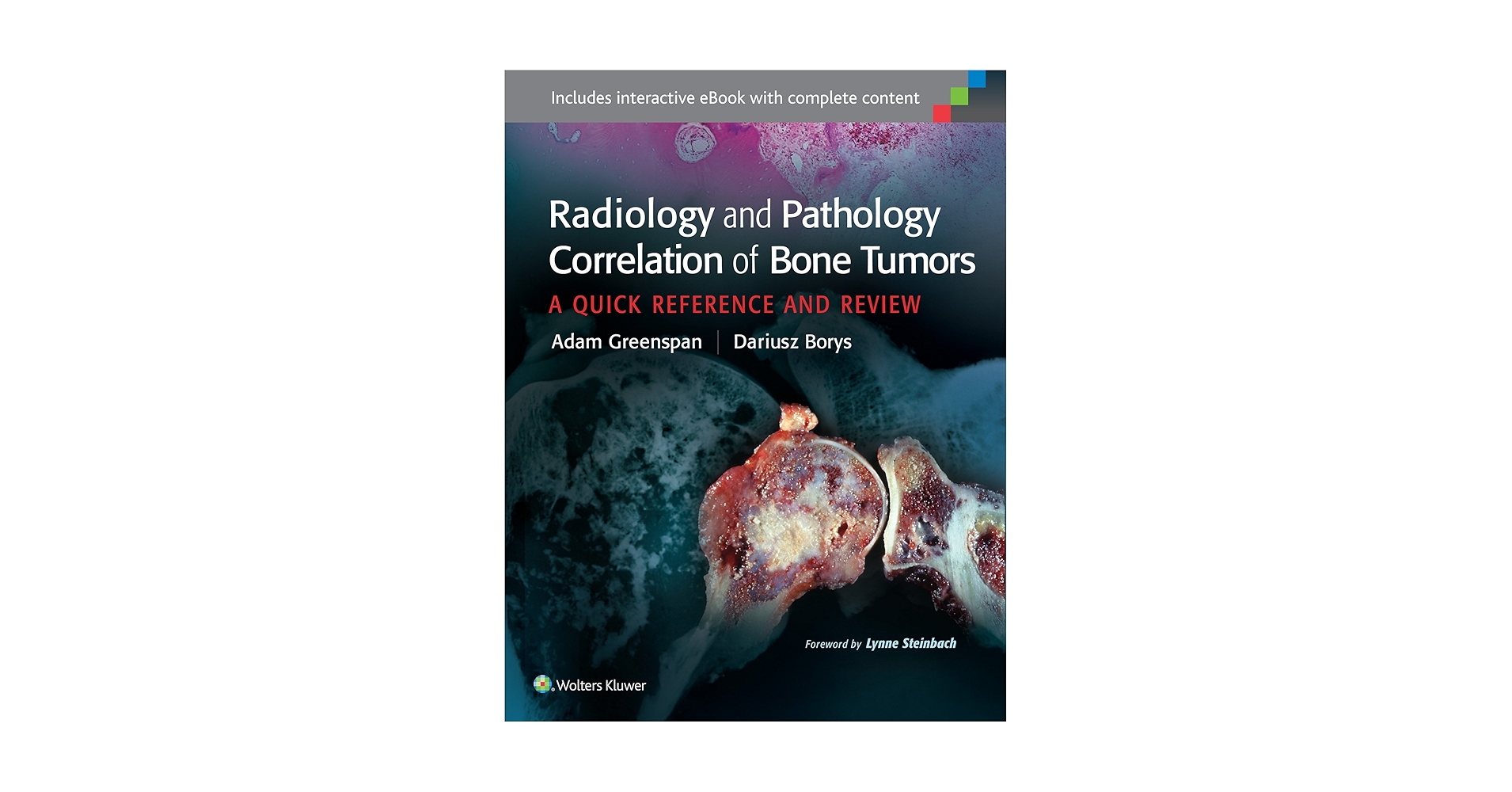 健康・医学 Radiology and Pathology Correlation Radiology and Pathology Correlation of Bone Tumors: A Quick