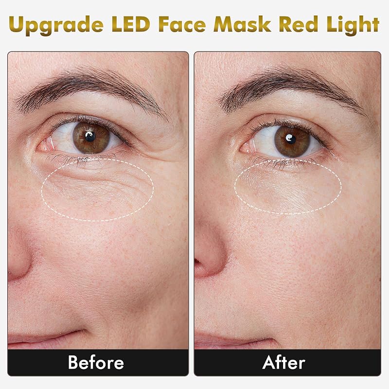 mhpoycd Silicone LED Face Mask with 7 Colors & 309 LEDs, Red Light Device for Face Neck Home SPA Beauty Salon image 3