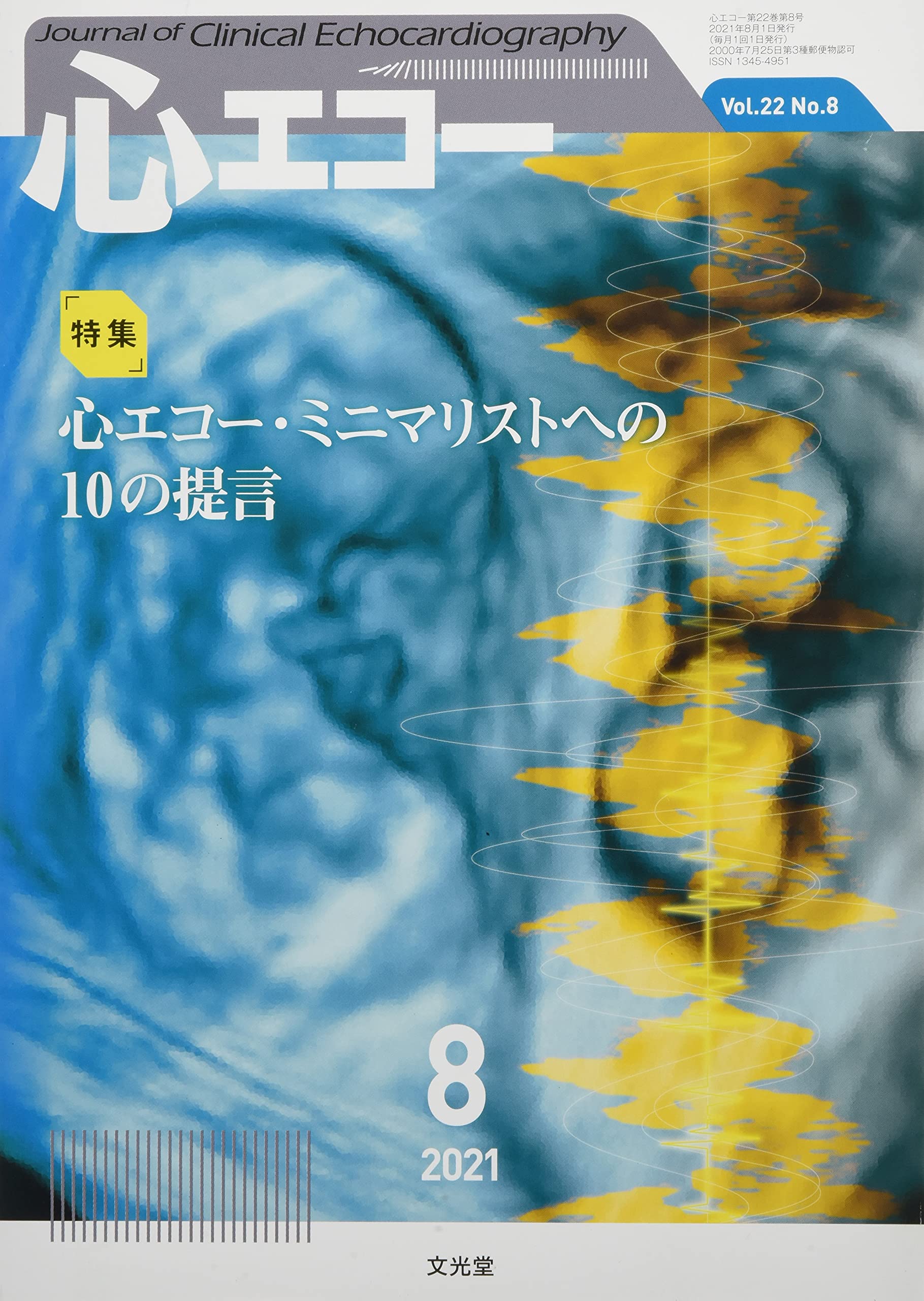 心エコー 2021年 08 月号 [雑誌] 心エコー 2021年 08 月号 [雑誌] |本 | 通販 | Amazon