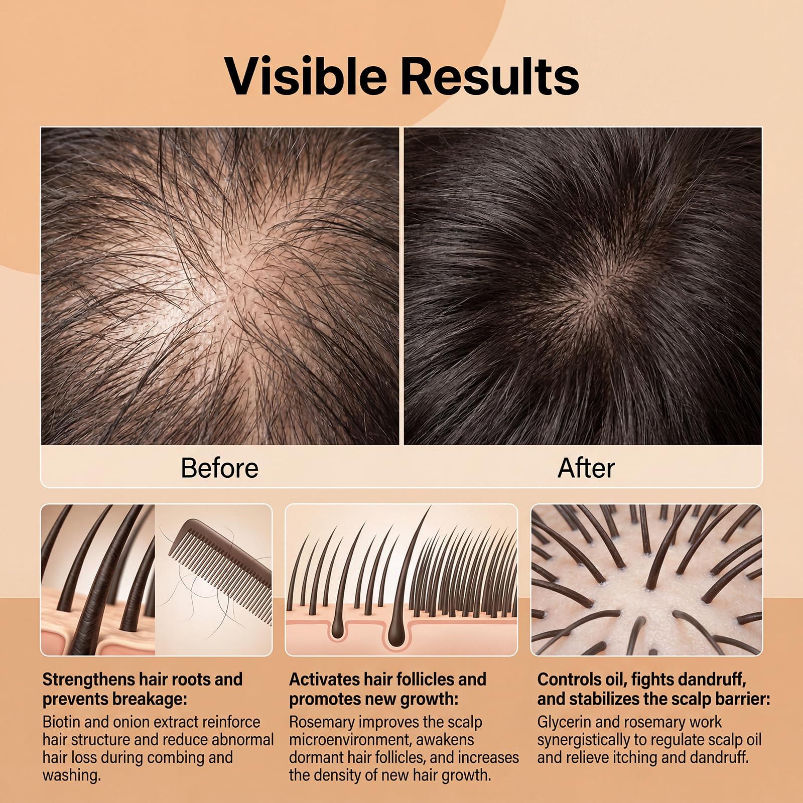 Onion Biotin Rosmarin Hair Serum Spray, Zwiebelshampoo Biotin Wachstumspflege dickeres Haar Verdickt Revitalisiert das Haar Pflegespray Wash Free Hairs Cares Oil Sprays, Frizz ease serum (8pcs)