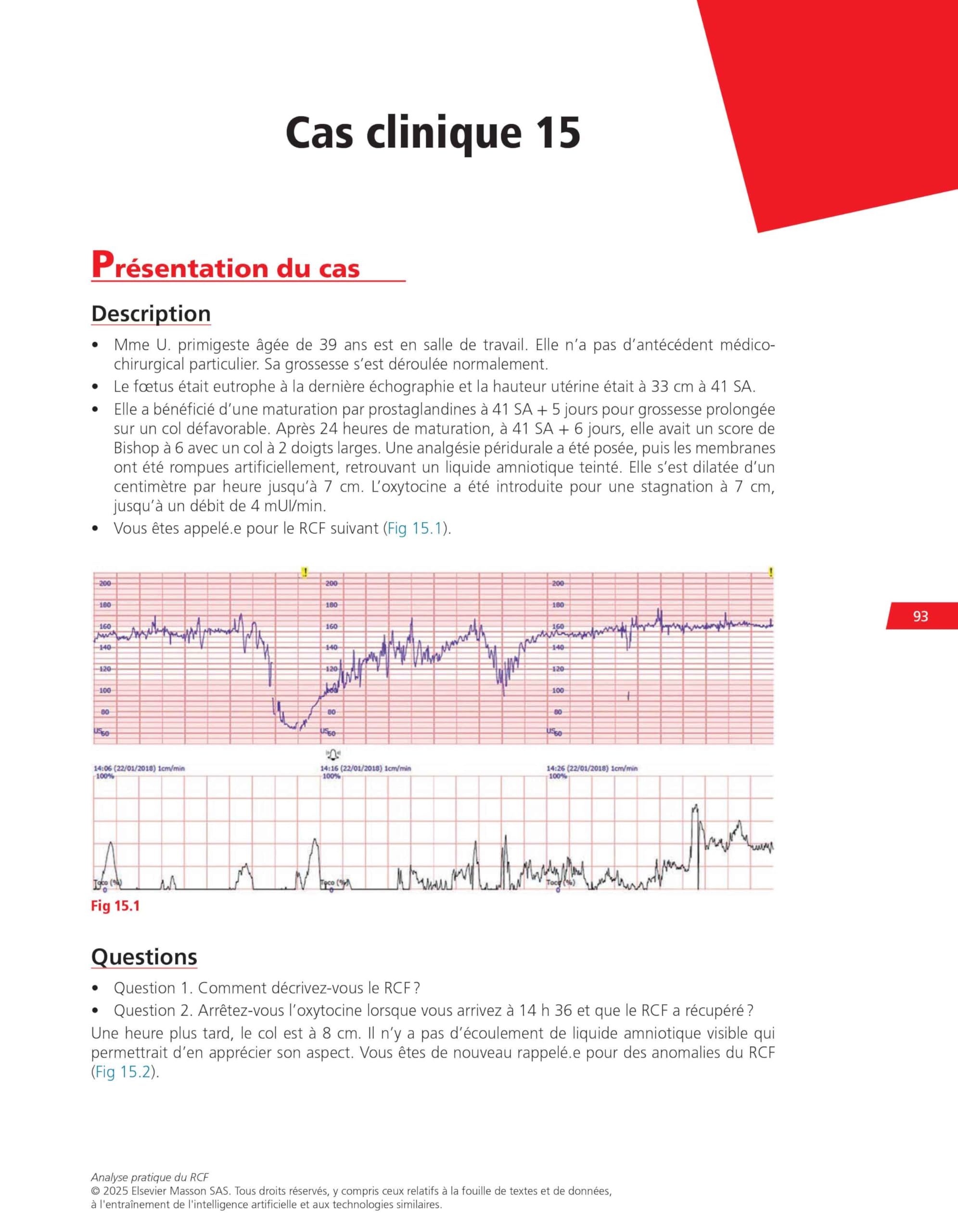 Analyse pratique du RCF : rythme cardiaque foetal: Méthodologie et cas cliniques commentés
