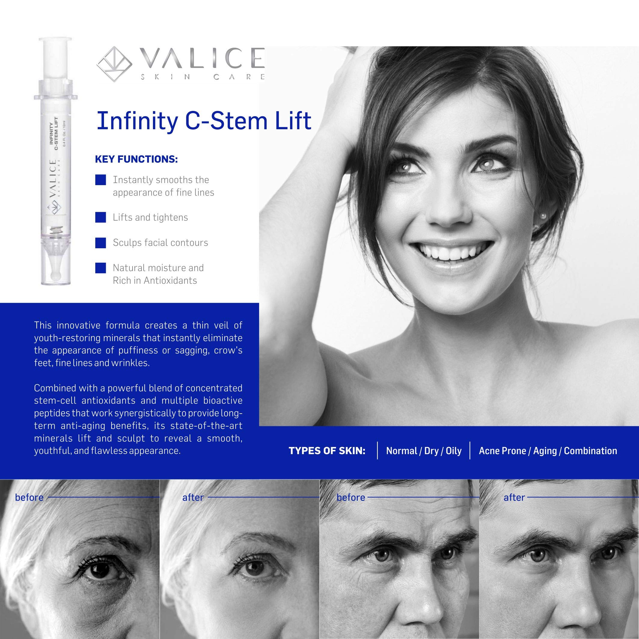 Valice Infinity C Stem Instant lift Micro Serum 