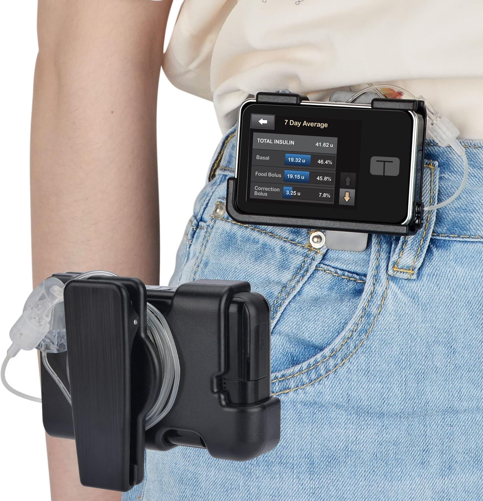 (Upgrade) 360° Rotating Case for tSlim X2 - Tandem Insulin Pump Holder for t:Slim t Slim G4 Accessories Spool Up Excess Tubing - t:Holster Smooth Edges Won't Peel Off Screen Cover - Black