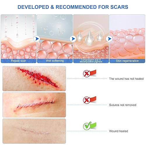Miniatura 8 de Cinta de silicona para cicatrices para recuperación de cesárea, hojas de silicona de grado médico para cicatrices quirúrgicas, hiperplásticas