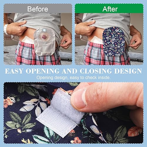 Miniatura 5 de Funda para bolsa de ostomía lavable de 8 piezas para mujeres y hombres, bolsas protectoras ligeras con apertura redonda, protector de cuidado de