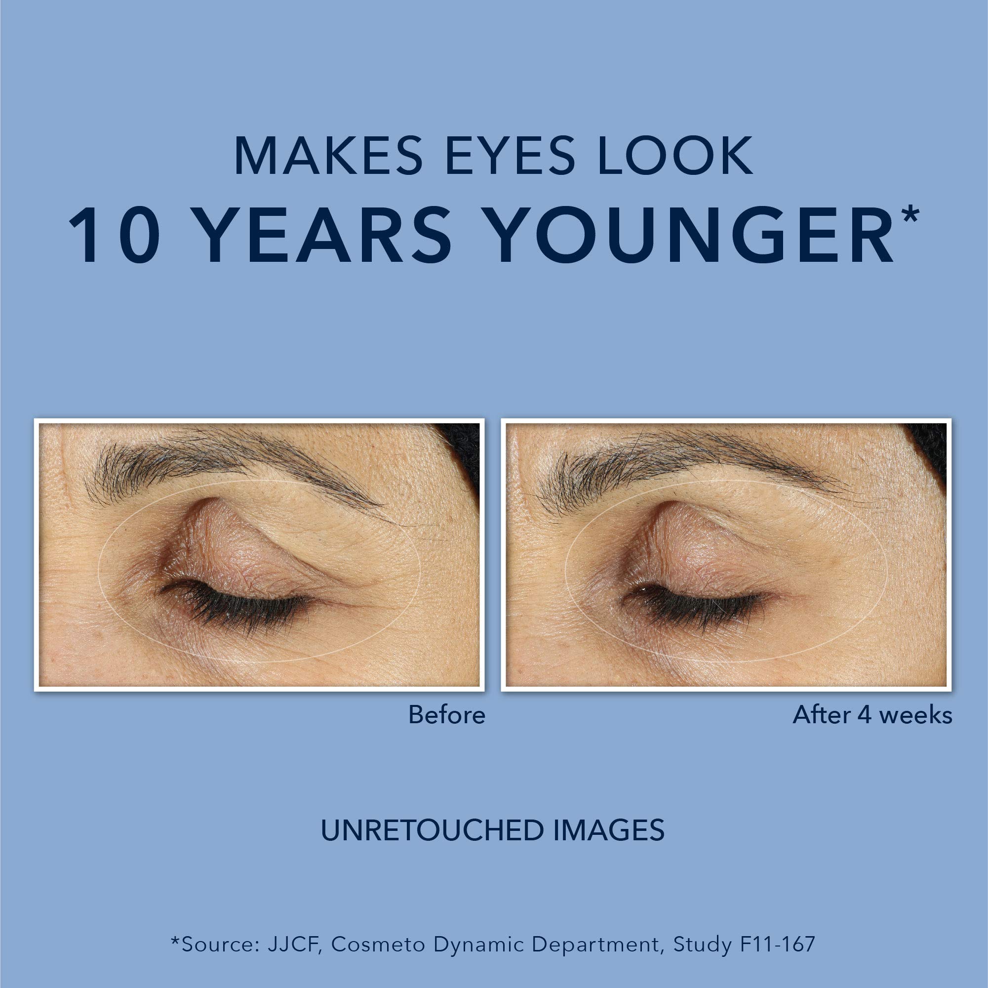 RoC Retinol Correxion Line Smoothing AntiAging Retinol Eye Cream for