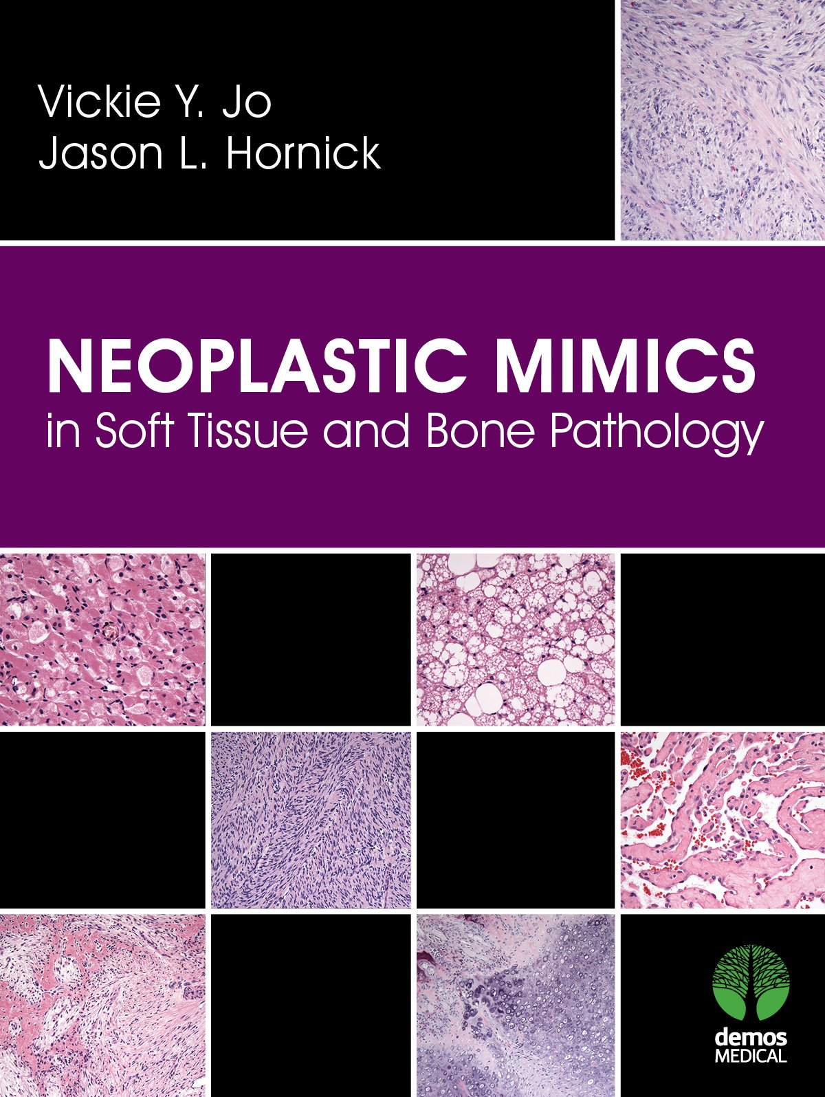 Neoplastic Mimics in Soft Tissue and Bone Pathology (Pathology of Neoplastic Mimics)