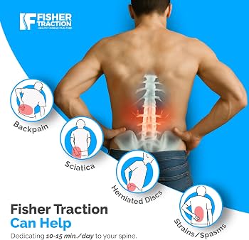 身体伸し用牽引機 特許品 Amazon.co.jp: Fisher Traction特許取得済み腰部牽引装置(230ポンド