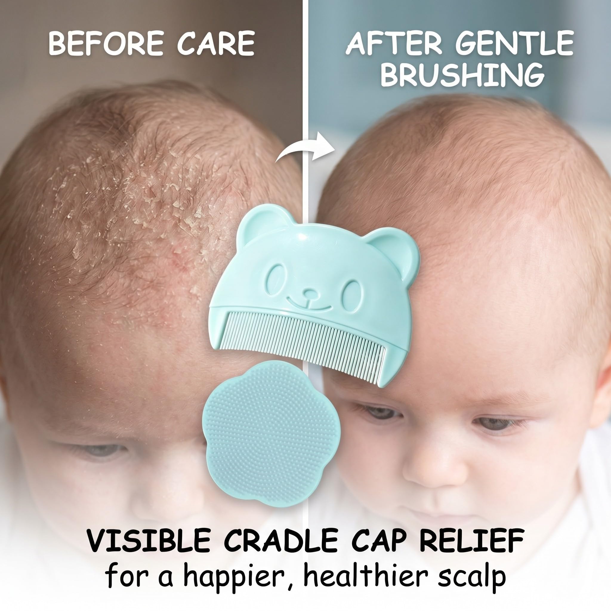 2 Pezzi Spazzola da Bagno per Neonati, pettine crosta lattea neonato, Spazzola per Bambini in Silicone, Pettine Neonato per Rimuovere La Crosta Lattea Del Bambino