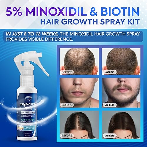 Miniatura 2 de 5% de minoxidil para hombres, minoxidil en aerosol, minoxidil para mujeres, crecimiento del cabello, minoxidil para hombres, crecimiento de barba,