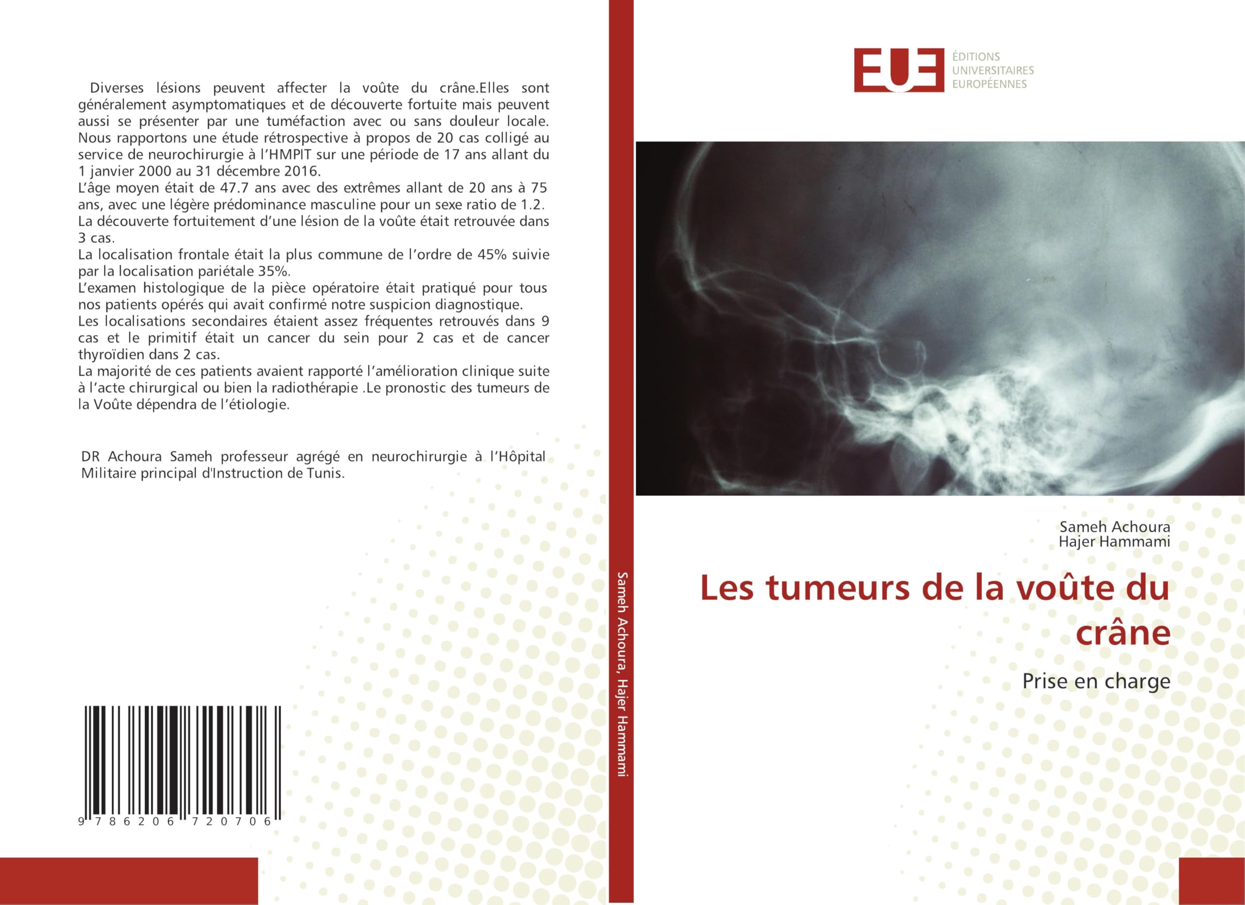 Les tumeurs de la voûte du crâne