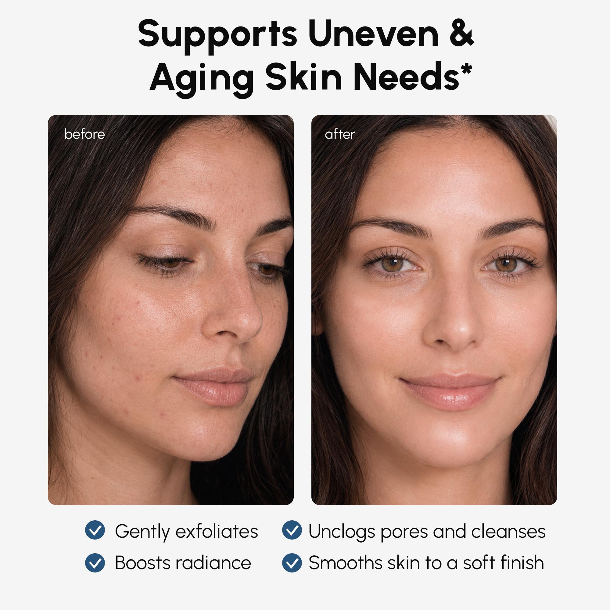 MAREE Toner Glykolsäure Peeling-Toner für Gesicht, 2 Stück, Acido Glicolico para Manchas