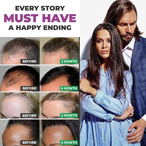 Miniatura 3 de ITZ OKY Cápsulas para el crecimiento del cabello - Revitaliza tu cabello cápsulas naturales para el crecimiento del cabello - 60 píldoras orgánicas