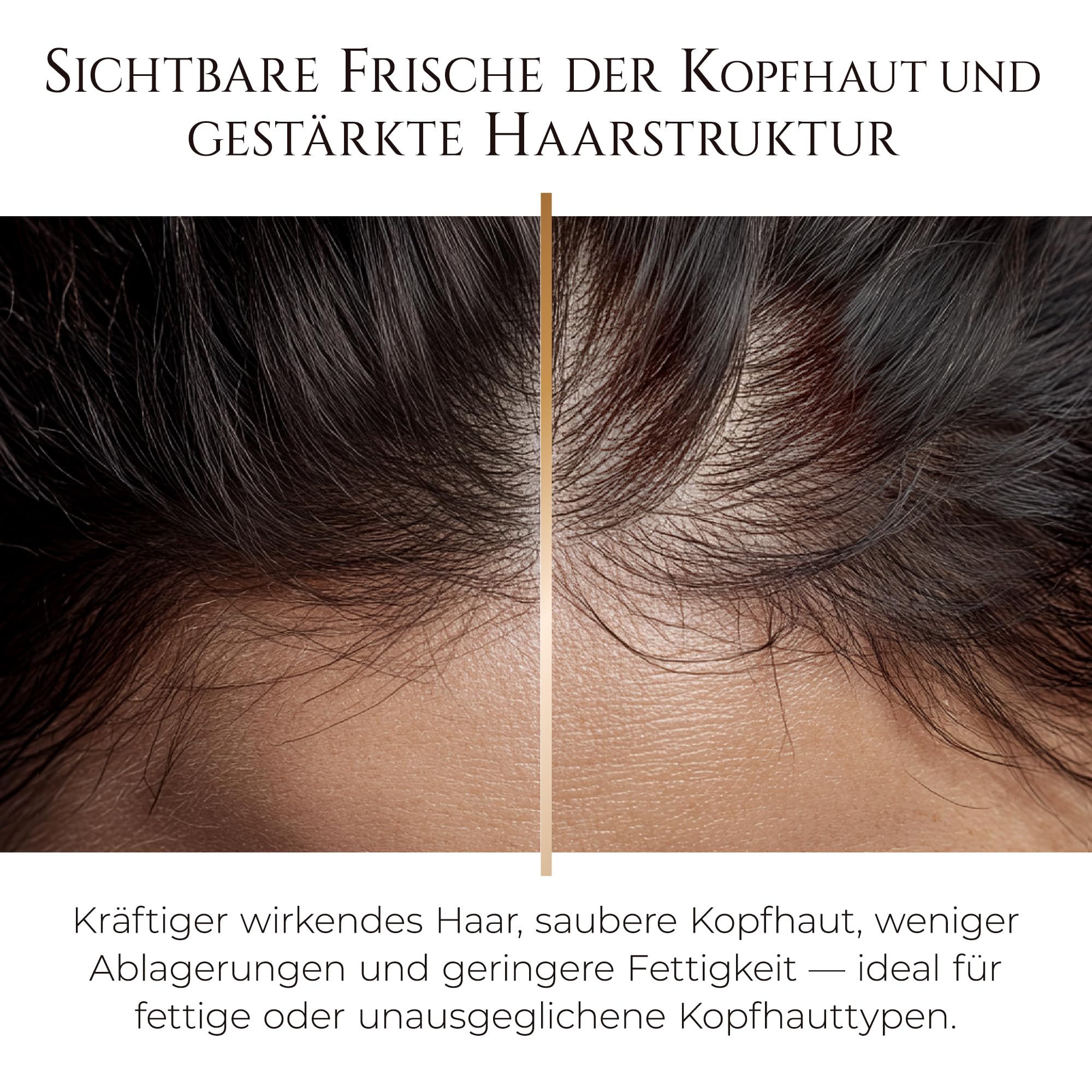 HADAT Root Strengthening Shampoo Haarwachstum Rosmarin Klärendes Anti-Schuppen Shampoo für fettige Kopfhaut Feuchtigkeit & Stärkung für Damen und Herren Made in Israel (800 ml)