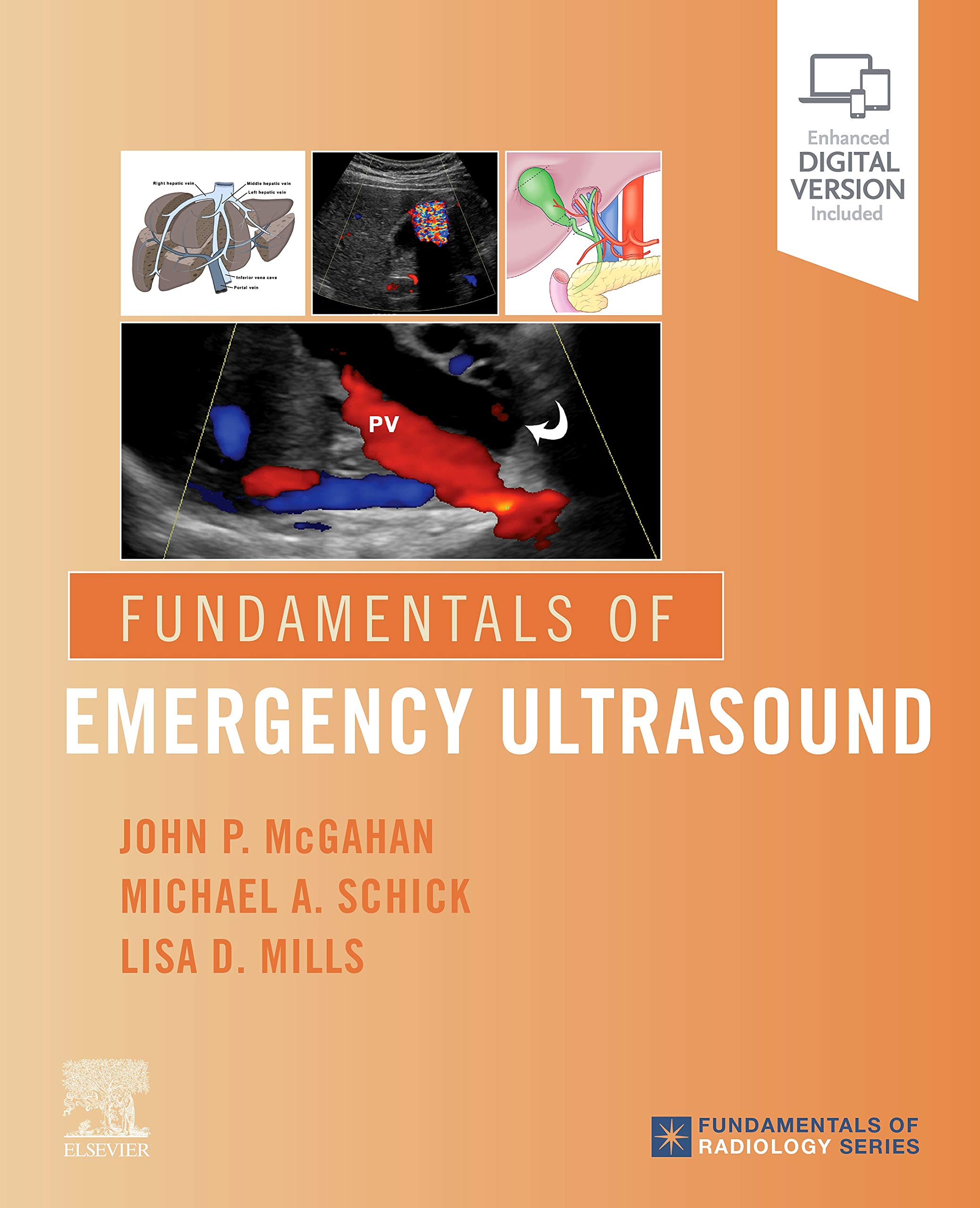 Fundamentals of Emergency Ultrasound - 9780323596428