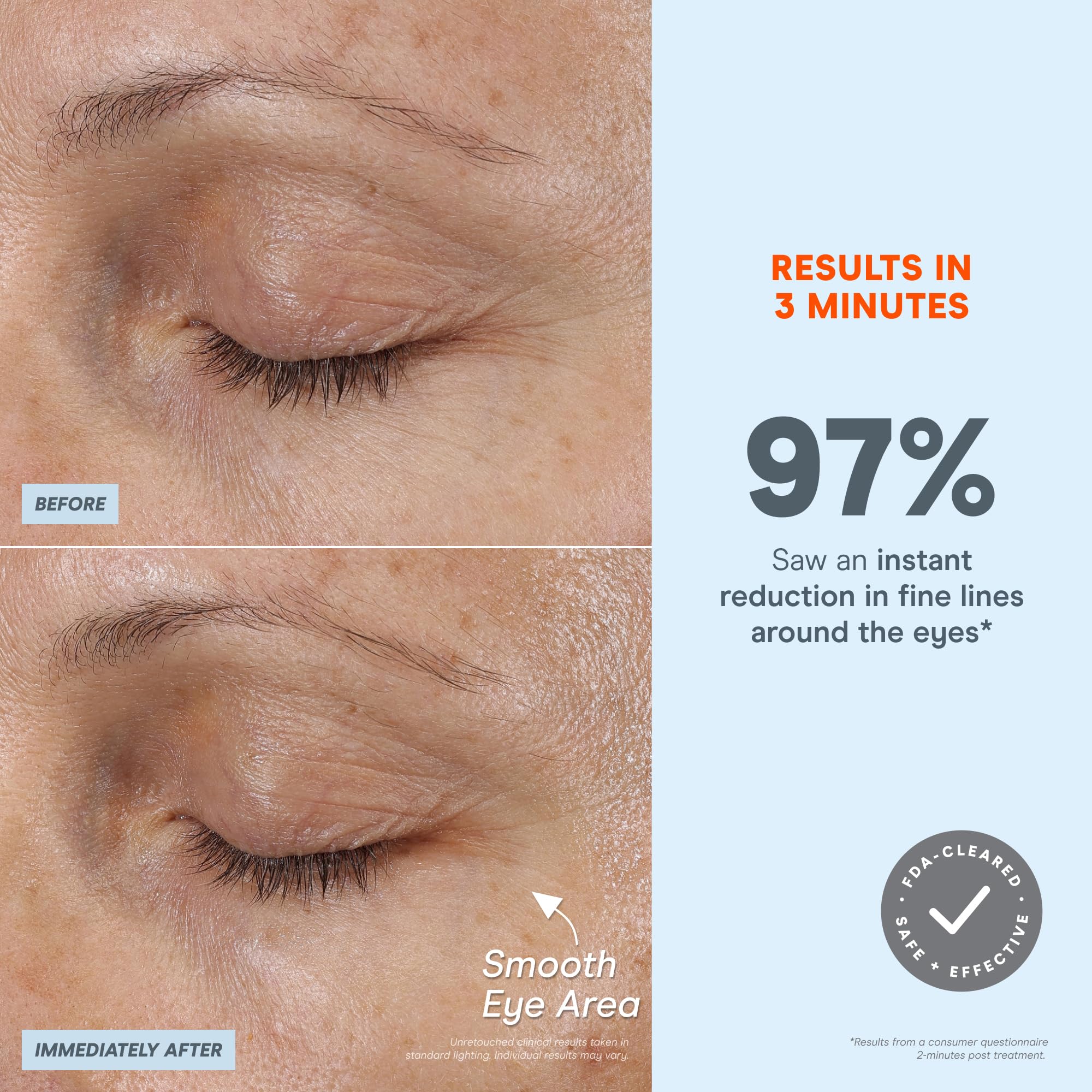 NuFACE FIX MicroWand - Microcurrent Device + Serum Activator for On-The-Go Treatment of Forehead Lines, Crow's Feet, Under Eyes, Smile Lines & Fuller-Looking Lips