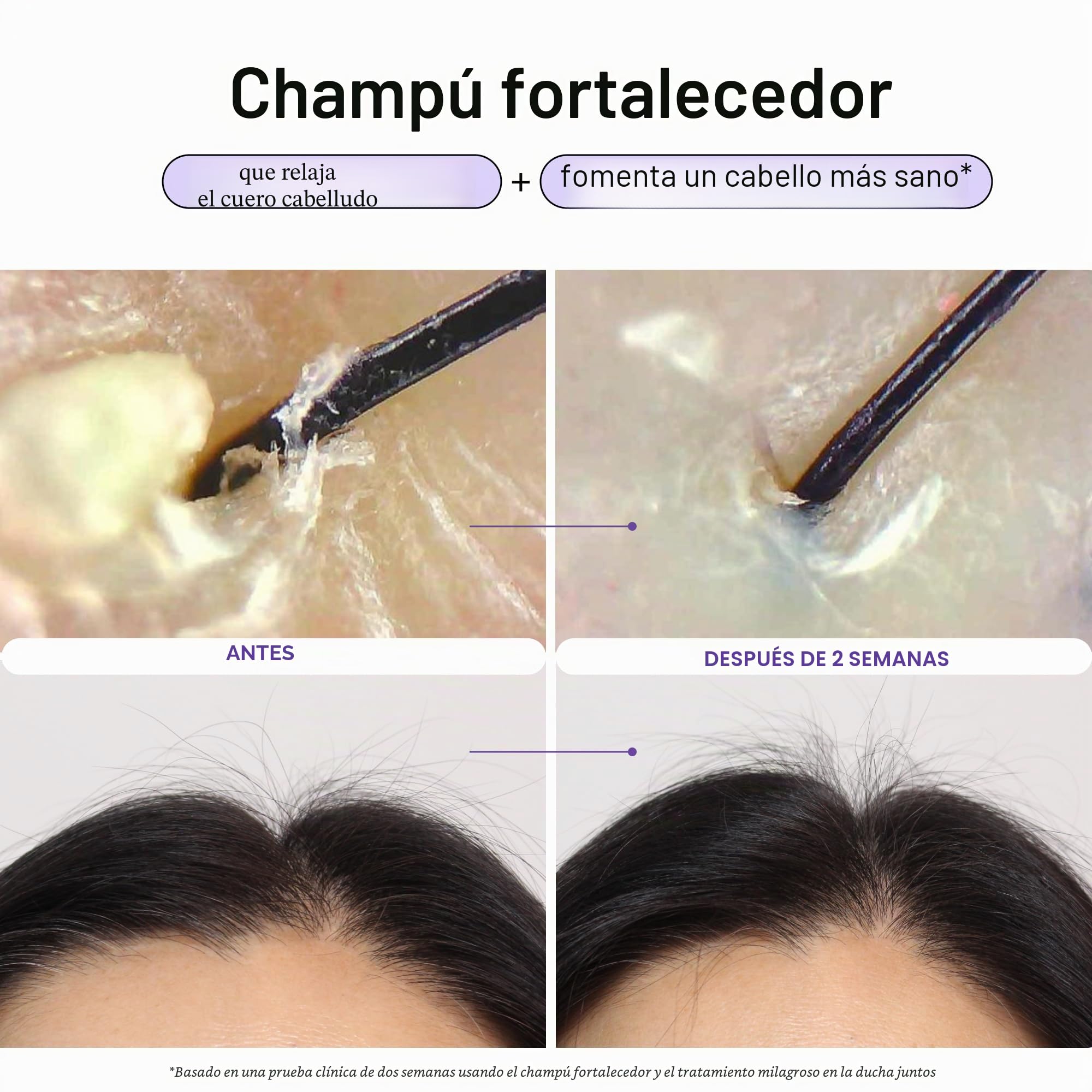 Dr. Groot Solución revitalizante para el cuero cabelludo, champú espesante para el cabello, con biotina y prebióticos, ayuda clínicamente a dar volumen visiblemente al cabello fino, dañado o seco, 385