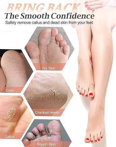 Miniatura 8 de Maryton Piedra pómez de pie para pies removedor de callos de piel dura y limpiador paquete de 4 azul Azul / Patchwork, Amarillo