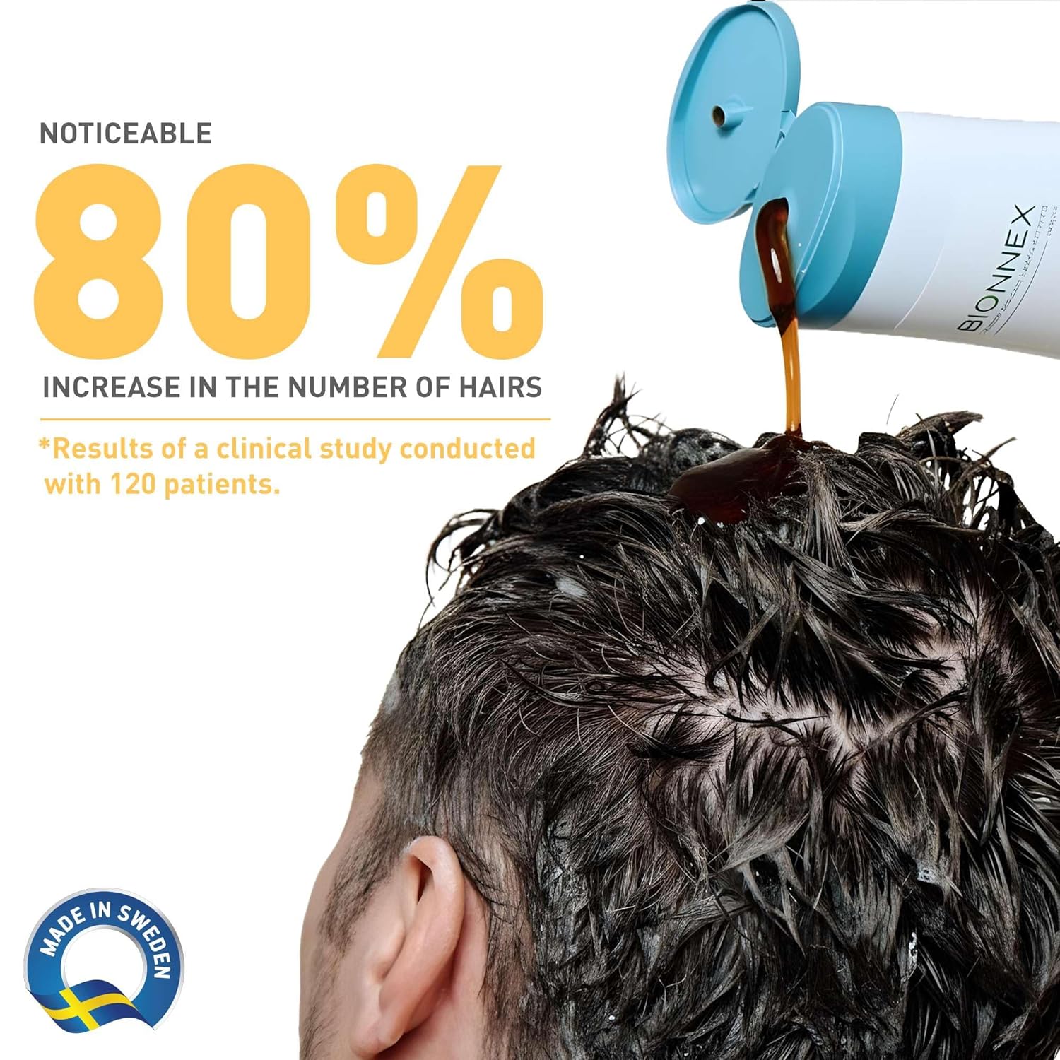 Anti-Hair Loss Shampoo for Dry and Damaged Hair, 10.14 fl.oz. Dermatologically and Clinically Tested, Restores Hair Vitality, Boost Hair Growth with BioTrust Technology Made in Sweden by Bionnex