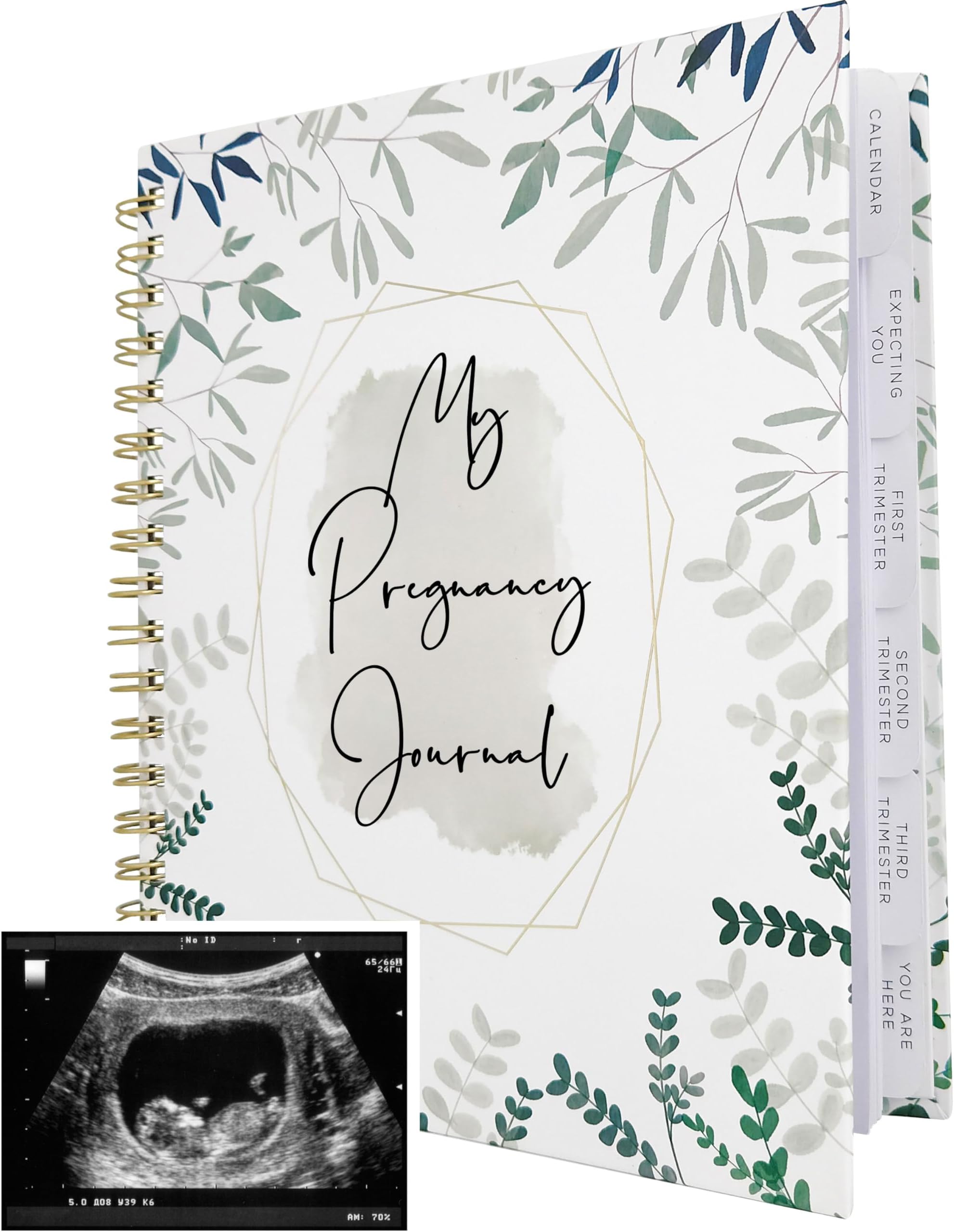 Pregnancy Journal for First Time Moms | Weekly Pregnancy Tracker & Baby Memory Book | 200-Page Pregnancy Planner | Pregnancy Must Haves Keepsake Gift | Premium Hardcover Pregnancy Book for Expecting