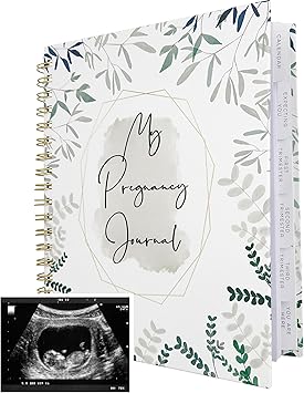 Pregnancy Journal for First Time Moms | Weekly Pregnancy Tracker & Baby Memory Book | 200-Page Pregnancy Planner | Pregnancy Must Haves Keepsake Gift | Premium Hardcover Pregnancy Book for Expecting Moms