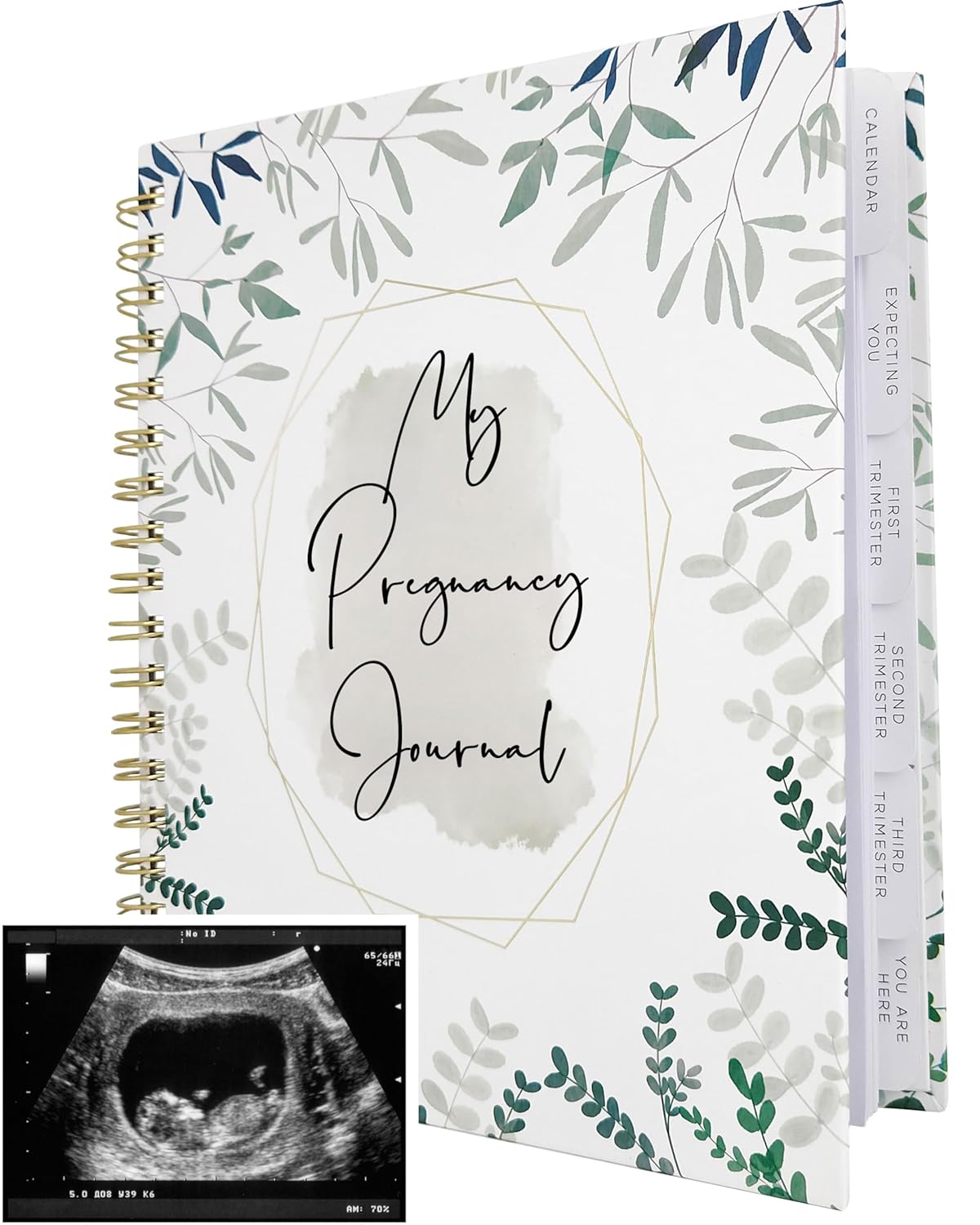 Pregnancy Journal for First Time Moms | Weekly Pregnancy Tracker & Baby Book | 200-Page Maternity Journal | Pregnancy Must Haves Keepsake Gift | Premium Hardcover Pregnancy Book for Expecting Moms