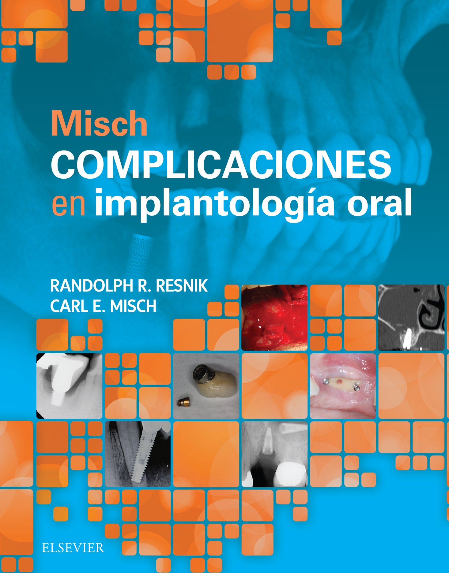 Misch. Complicaciones en implantología oral (Spanish Edition)
