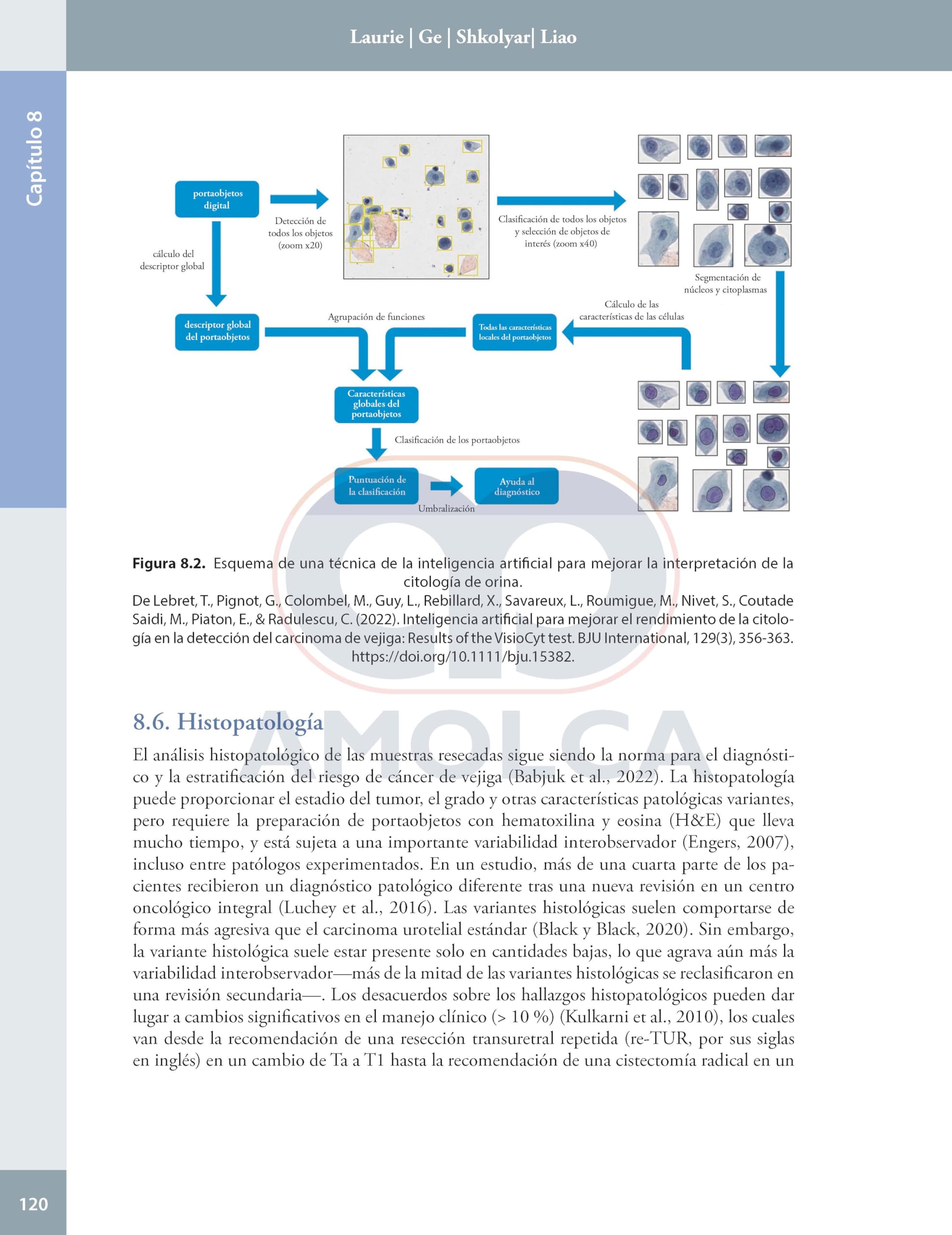 Inteligencia artificial en urologia presente y futuro