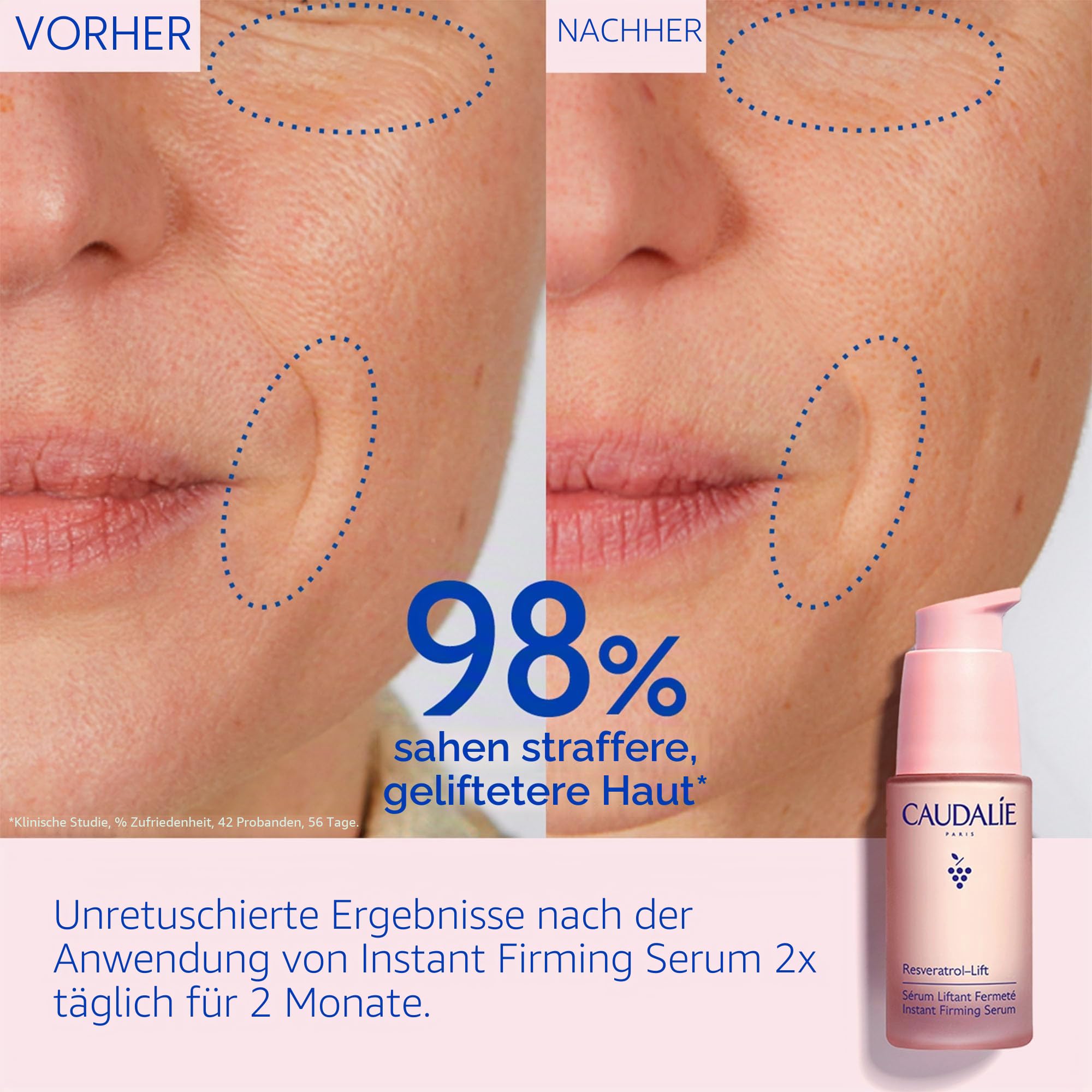 Caudalie Resveratrol-Lift Lifting Straffungsserum mit Resveratrol, Alternative zu Retinol