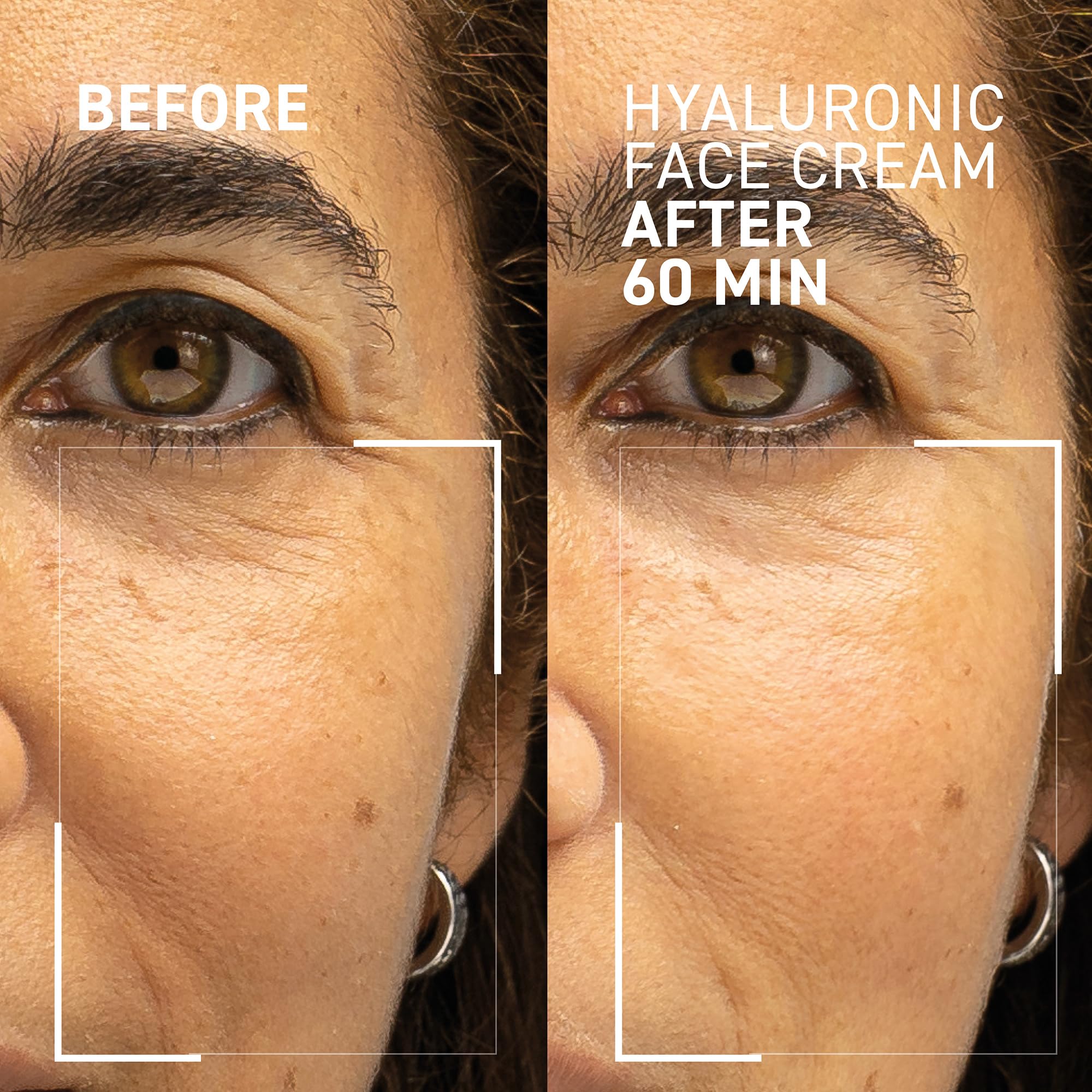Dr. Brandt Needles No More Hyaluronic Face Cream - Long-Lasting Plumping Hydrator for Dehydrated & Dry Skin - 50 g - Image 2