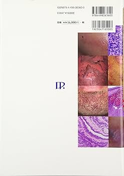 皮膚科カラーアトラス―臨床像と組織像 3版 | 石川 治 |本 | 通販