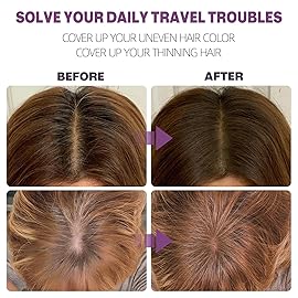 Abomet Hairline Powder Instantly Conceals Hair Loss, Root Touch Up Hair Color Powder, Hair Toppers for Women Men, Hair Fibers for Thinning Hair, Root Cover Up lasting 24 hours (Medium Brown, 0.35)