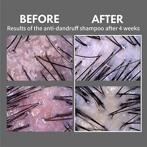 Miniatura 7 de LA'DOR LADOR Champú anticaspa (16.9 onzas líquidas) - Para cuero cabelludo graso con caspa, limpia suavemente las células muertas de la piel, alivia