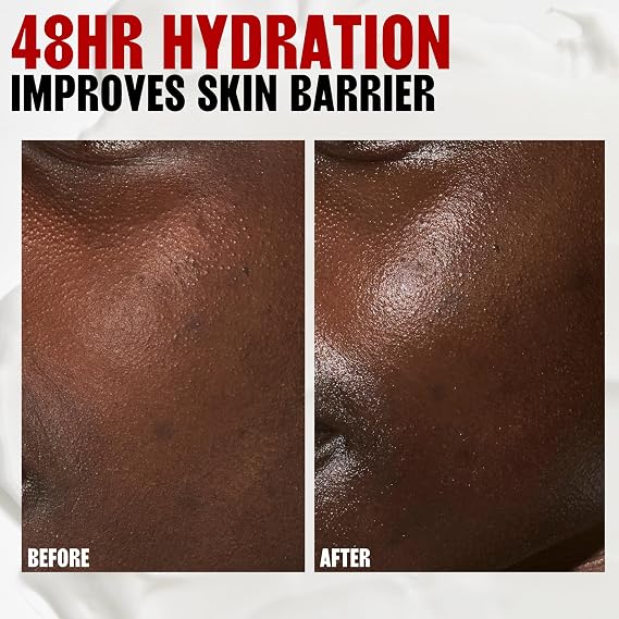 THAYERS Milky Hydrating Face Toner with Snow Mushroom Tremella, Hyaluronic Acid and Elderflower, Dermatologist Recommended Gentle Alcohol Free Skincare for Dry & Sensitive Skin, Paraben Free, 3 Fl Oz