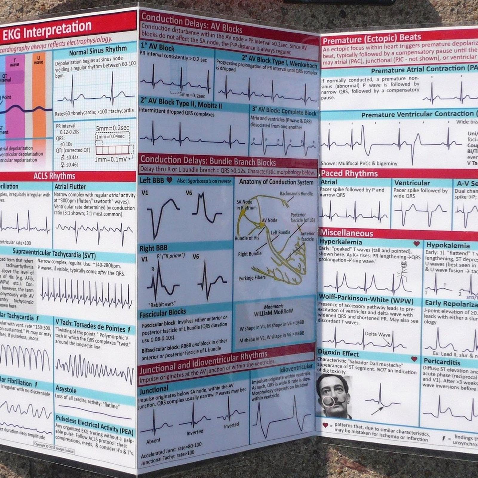 EKG-Taschen-Anleitung, Stabiles EKG-Lernwerkzeug, Perfekt Für Hochfrequenzanwendung, EKG-Taschenleitfaden Für Die Krankenpflegeschule Für Krankenhäuser, Für Krankenhaus, Zuhause, Schule