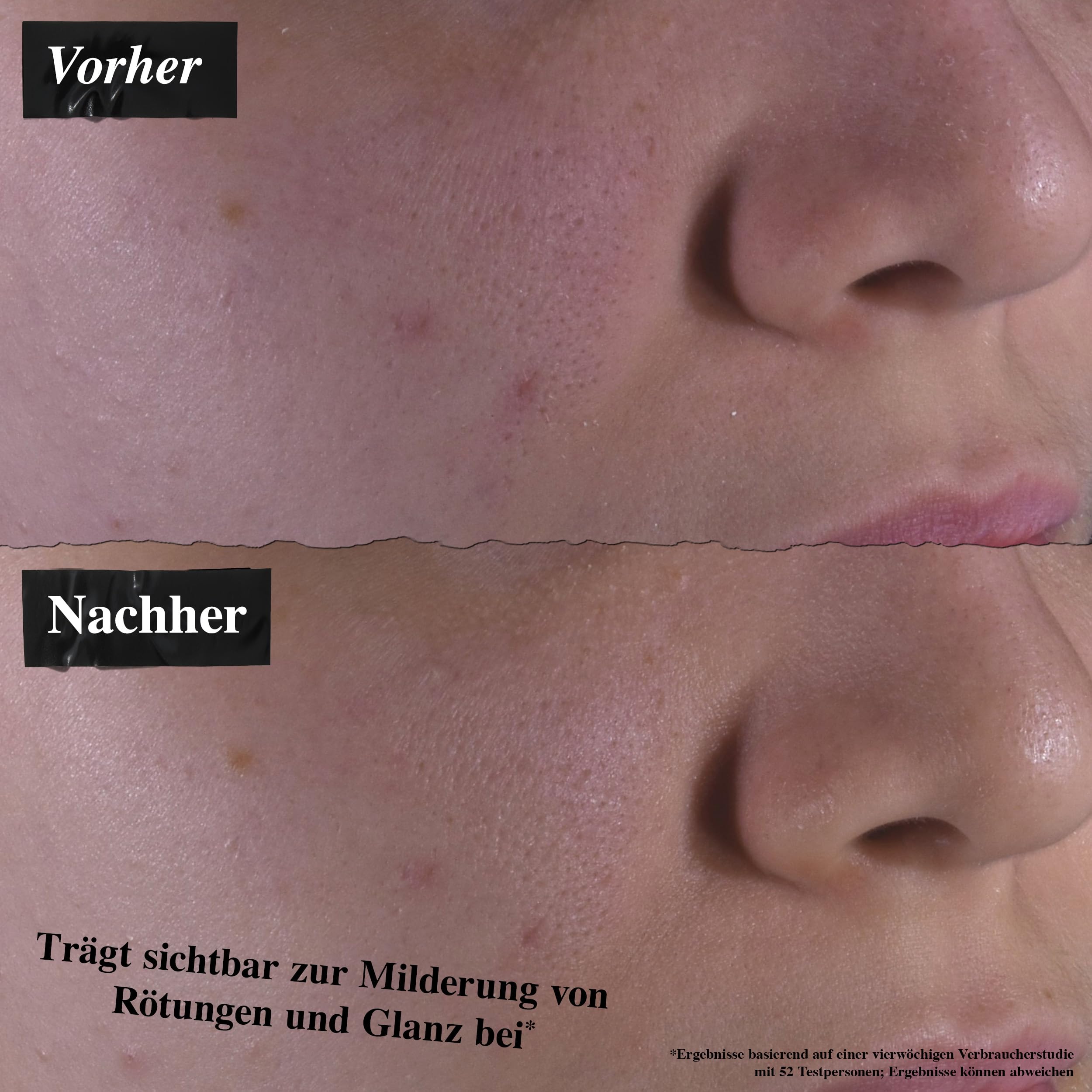 KIEHL'S Calendula Herbal Extract Toner, alkoholfreies Gesichtswasser auf Basis von Ringelblumen, für normale bis fettige Haut, hautberuhigend
