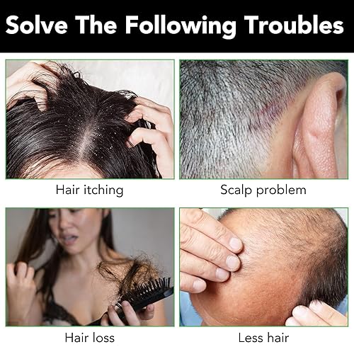 Miniatura 5 de Tudiqe Champú de aceite de ricino negro jamaicano para el crecimiento del cabello, fortalece y restaura, champú de ricino negro jamaicano para