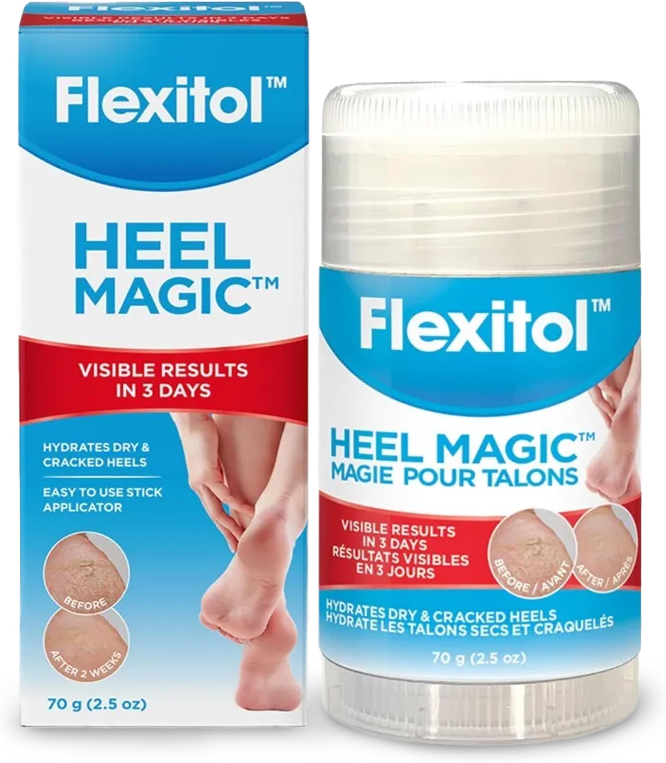 Flexitol Heel Magic For Dry Skin or Rough Heels with Shea Butter & Vitamin E, 2.5 Ounce