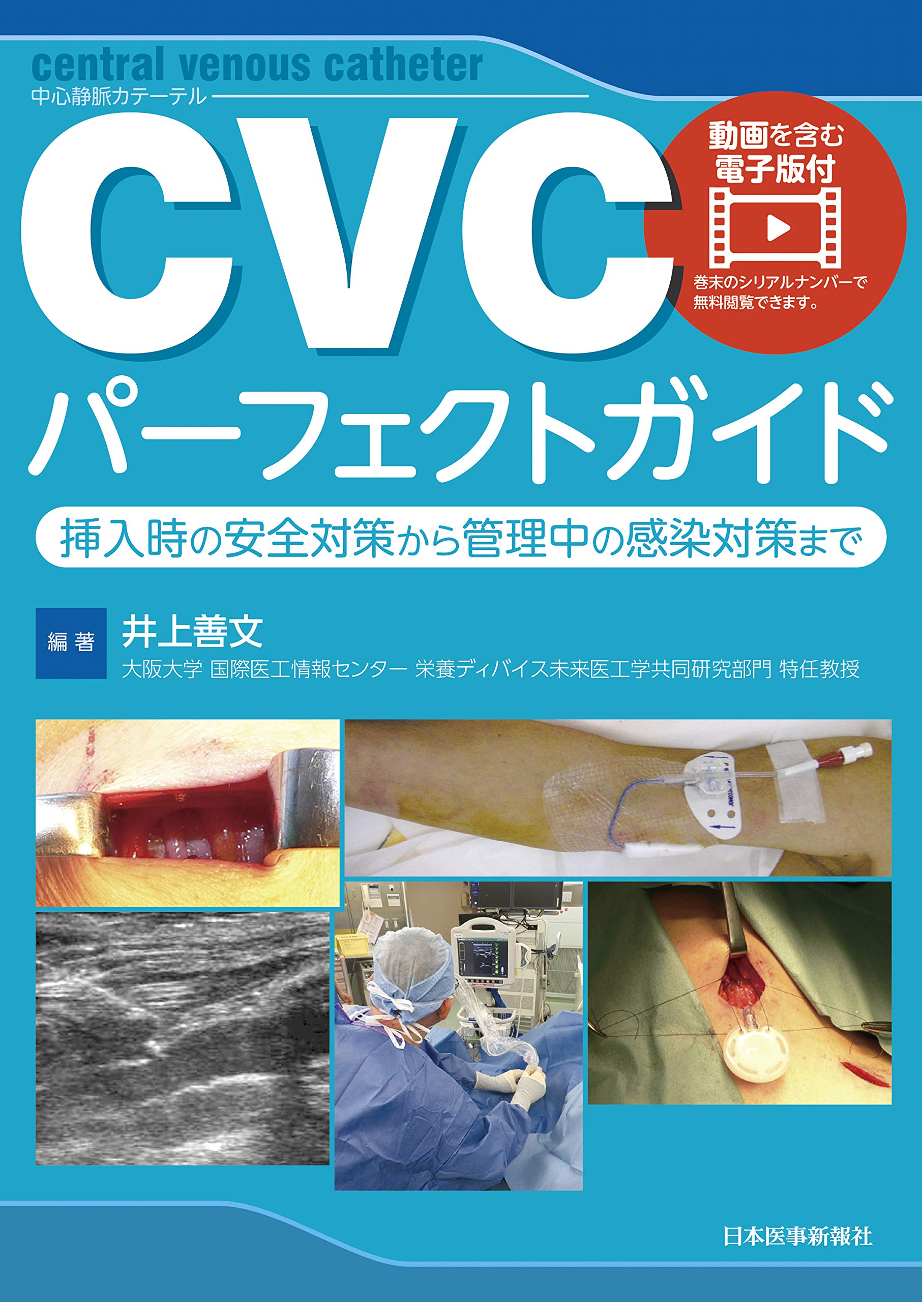 CVCパーフェクトガイド【動画を含む電子版付】挿入時の安全対策から
