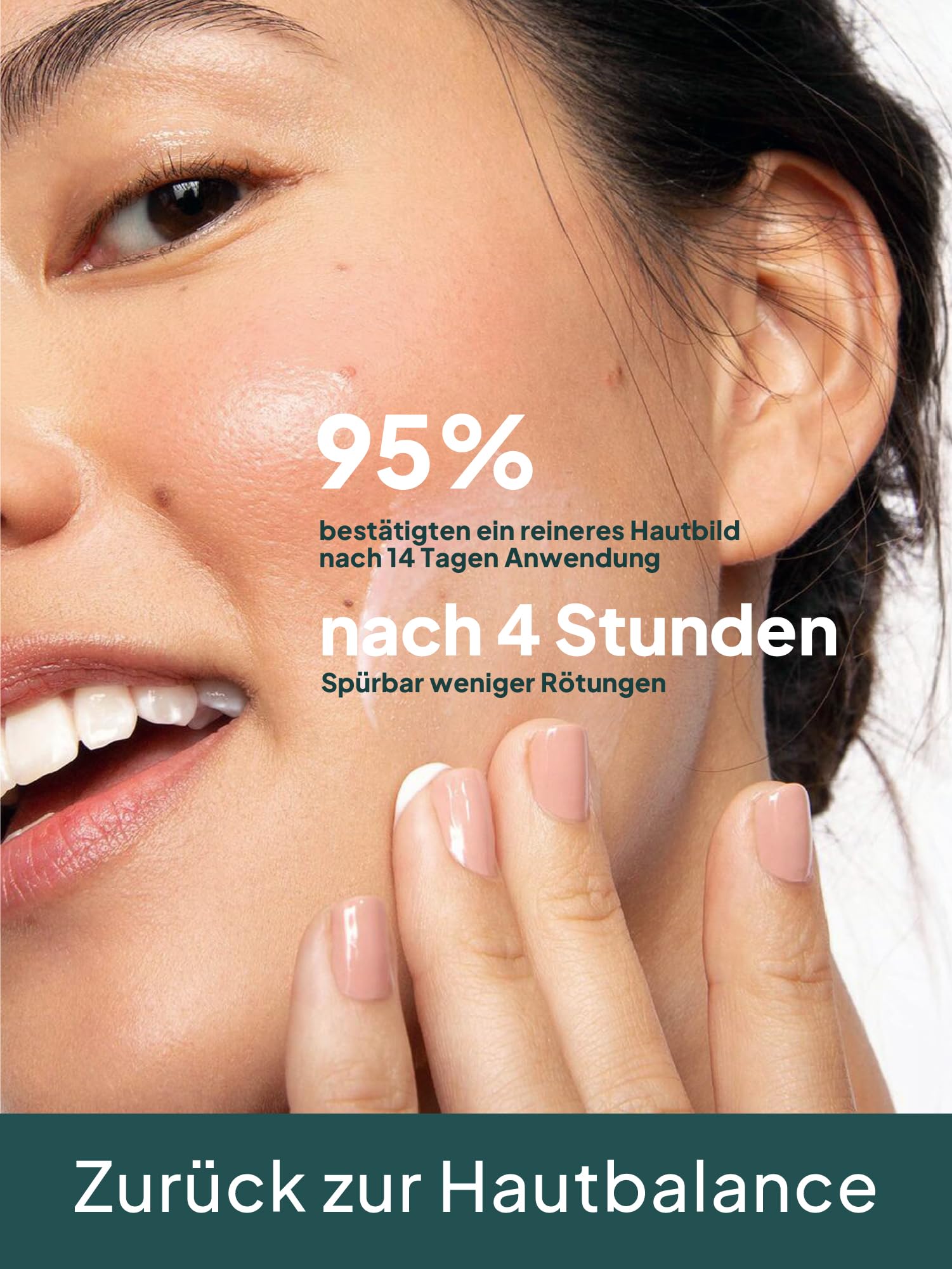 GRÜNE VALERIE® Zinksalbe gegen Pickel 100ml [HOCHDOSIERT] - Mit Teebaumöl, Salicylsäure & Niacinamid - Anti Pickel Creme - Hautbalance - Zink gegen Akne - Gesichtspflege unreine Haut mit Propolis