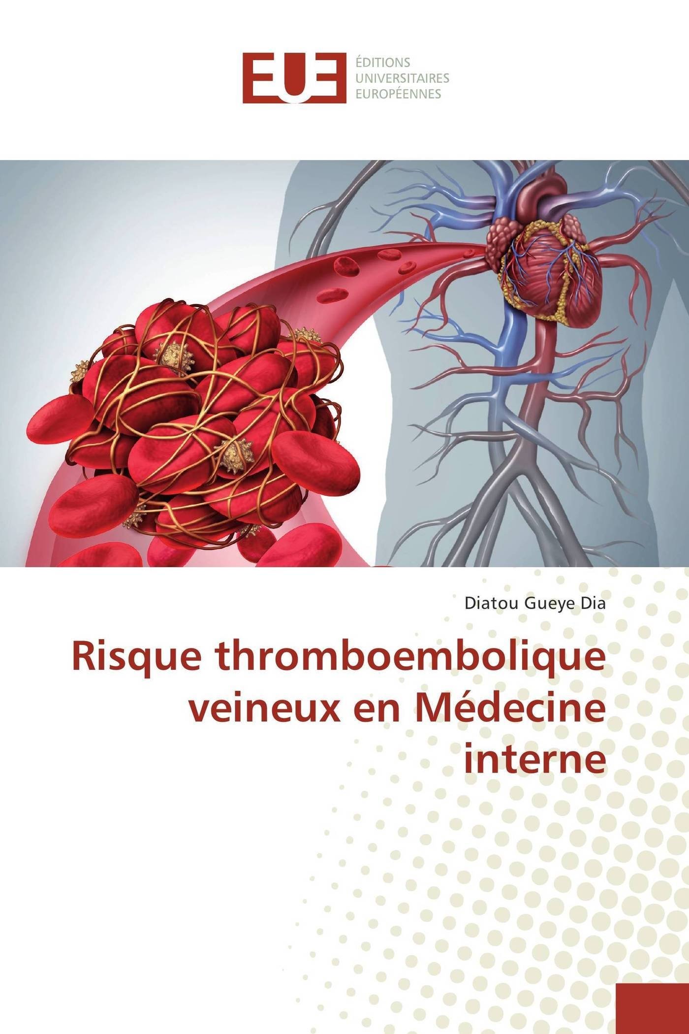Risque thromboembolique veineux en Médecine intern