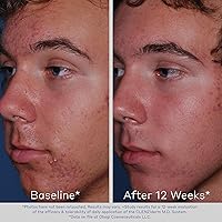 Vista 2 de Sistema Obagi Clenziderm M.D., (3 u)