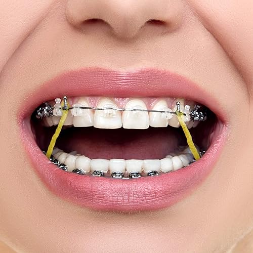 Miniatura 6 de JMU Paquete de 100 bandas elásticas ortodónticas de 14 pulgadas, 6.5 onzas, bandas elásticas intraorales pesadas sin látex, bandas de goma dentales