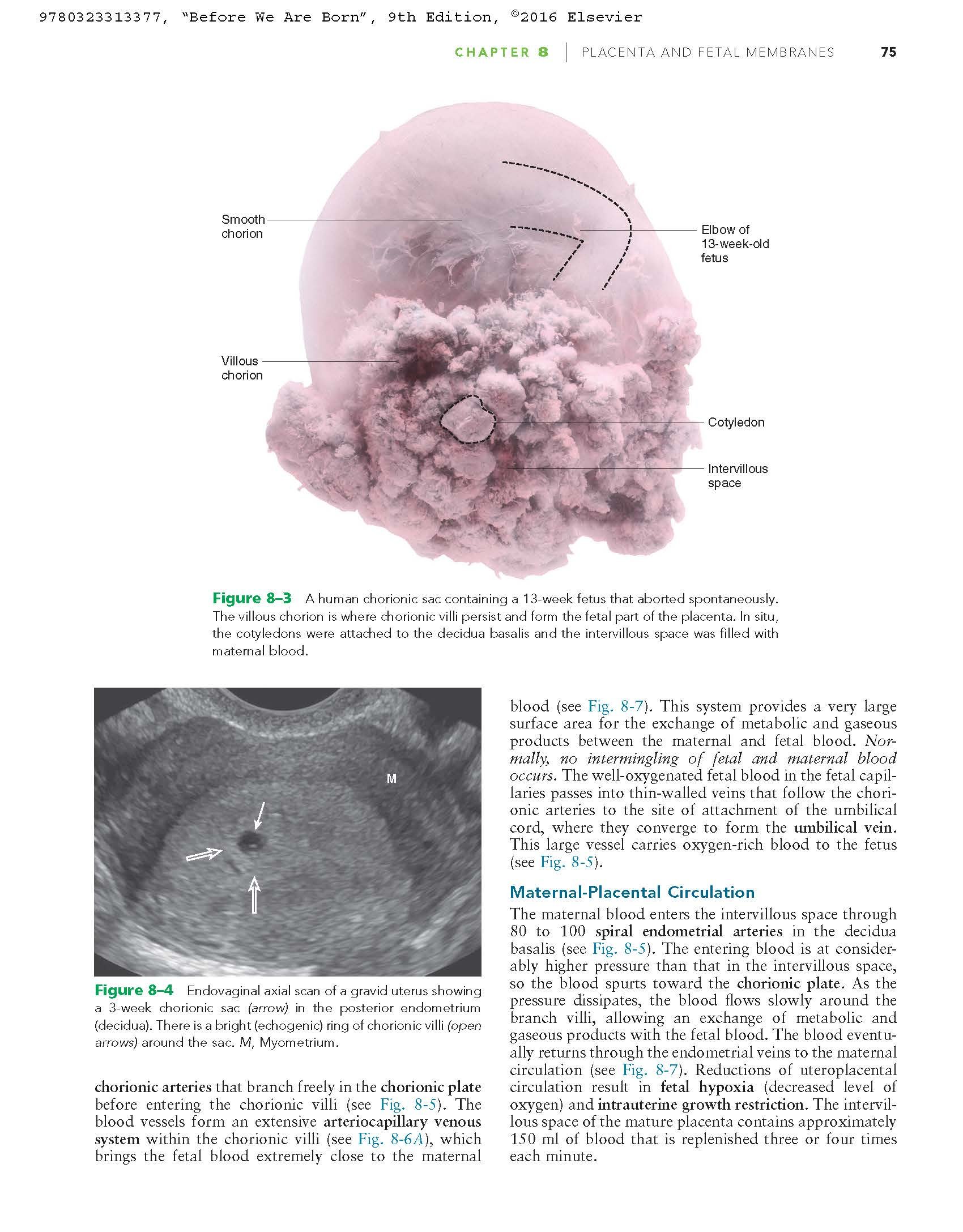 Before We Are Born: Essentials of Embryology and Birth Defects
